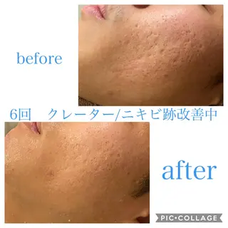 ショート カラー パーマ ヘアアレンジ メンズ ネイル マツエク・マツパ EnsorClair 代表 野口真央のエステ・リラクイメージ