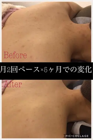 ミディアム カラー パーマ ヘアアレンジ メンズ キッズ ネイル マツエク・マツパ ニキビ・肌質改善専門 ♡人生が変わるサロンのエステ・リラクイメージ