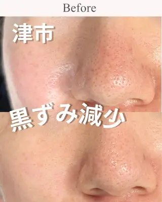 Balance facialのエステ・リラクイメージ