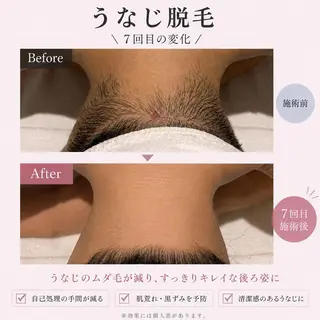 【メンズ脱毛・美肌】 SARA 恵比寿店のエステ・リラクイメージ