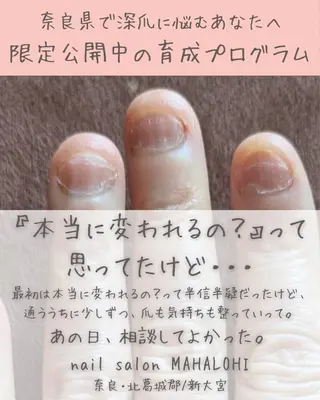 ネイル 深爪・自爪育成専門 MAHALOHIのネイルデザイン