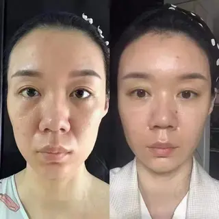 ネイル 愛維美水光専門店 川崎彩鳳のエステ・リラクイメージ