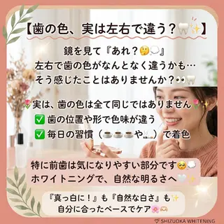 ホワイトニング ショップ葵区静岡駅店のその他イメージ