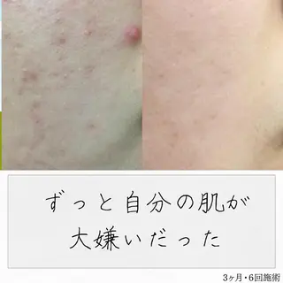 ニキビ経験者が施術 する専門サロン🌻のエステ・リラクイメージ