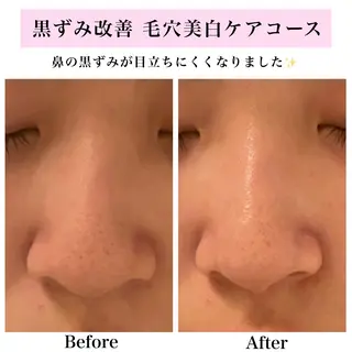Bellesthe (ベルエステ)のエステ・リラクイメージ