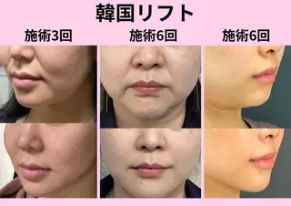 マツエク・マツパ 愛維美水光専門店 川崎彩鳳のエステ・リラクイメージ