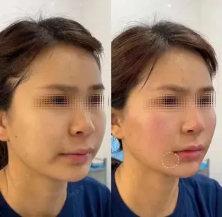 ネイル 愛維美水光専門店 川崎彩鳳のエステ・リラクイメージ