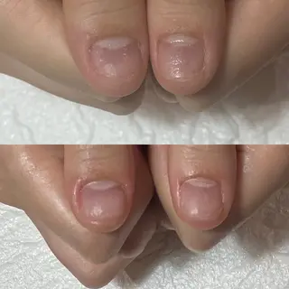 ネイル 自爪育成・巻き爪 補正講師 津蔵のネイルデザイン