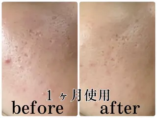 POLA The Beauty印場店のエステ・リラクイメージ