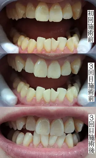 エステサロン LYSH愛名のエステ・リラクイメージ