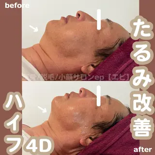 beauty salon epのエステ・リラクイメージ