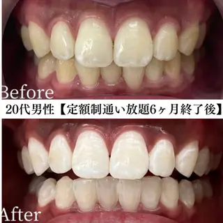 メンズ キッズ セルフホワイトニング WHITE福岡天神店のエステ・リラクイメージ