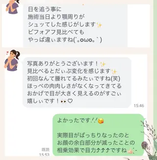リフトアップ小顔矯正 いまいあやののその他イメージ