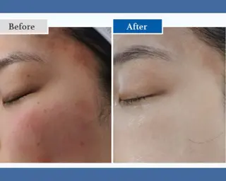 Salon💫 Lino'a柏店のエステ・リラクイメージ