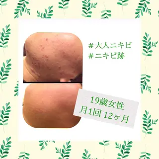 ミディアム カラー パーマ ヘアアレンジ メンズ キッズ ネイル マツエク・マツパ ニキビ・肌質改善専門 ♡人生が変わるサロンのエステ・リラクイメージ