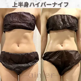 aimer服部 /  小顔 ・ 痩身のその他イメージ