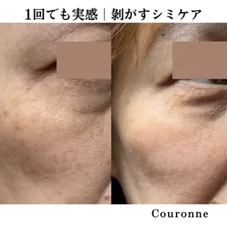 シミ・毛穴ケア専門 クロヌYUKIのエステ・リラクイメージ