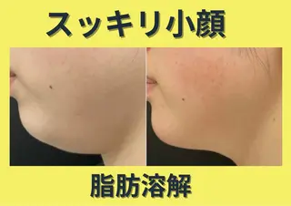 メンズ 【BUB立川】 ゆかのエステ・リラクイメージ