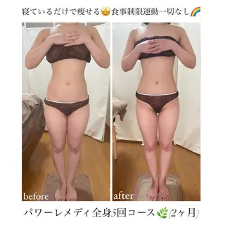 《本気痩せ×疲労改善 》  BILOOPのエステ・リラクイメージ
