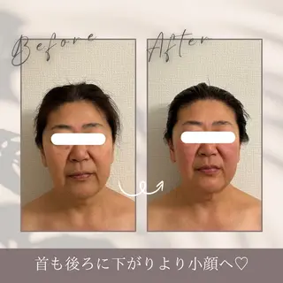 小顔セラピー LILのエステ・リラクイメージ