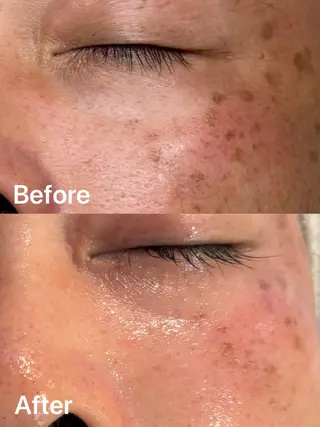 facial salon D 吉沢のエステ・リラクイメージ