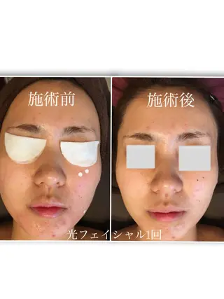 シマダ ユキコのネイルデザイン