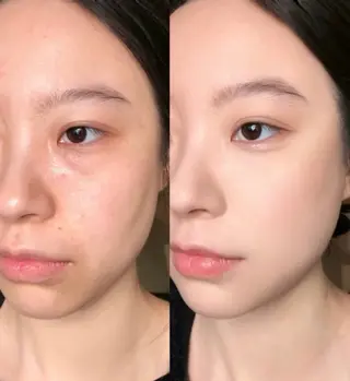 愛維美水光美肌専門店 メンズレディースokのエステ・リラクイメージ