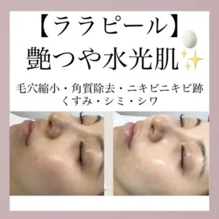 モエ ｜青葉台 脱毛のエステ・リラクイメージ