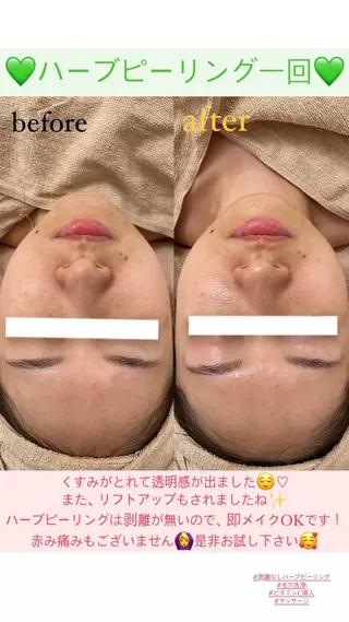 メンズ Salon de Lino 御器所のエステ・リラクイメージ