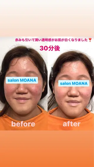 小顔美肌salon MOANAのエステ・リラクイメージ