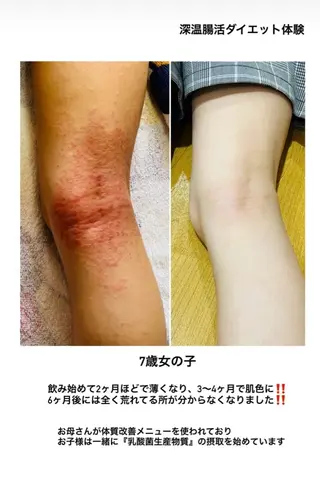 パフォーマンス最大化 美ボディメイクのエステ・リラクイメージ