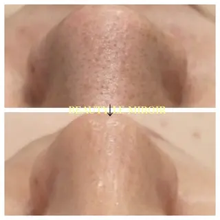 ビューティー ミロワールのエステ・リラクイメージ