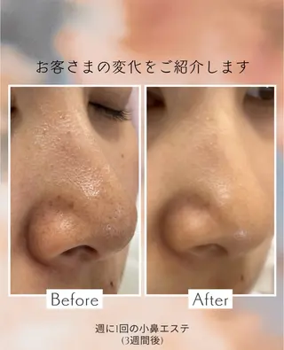 肌質改善 ×ネイルサロンのエステ・リラクイメージ