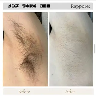 メンズ 脱毛&フェイシャル/ Rappore;増田のエステ・リラクイメージ