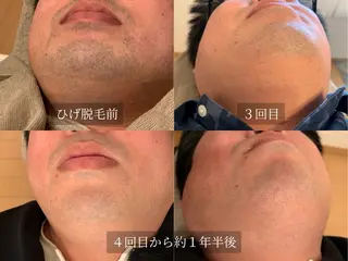 脱毛サロン Arumのエステ・リラクイメージ