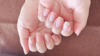 ネイル 美容爪 クリニックサロンのネイルデザイン