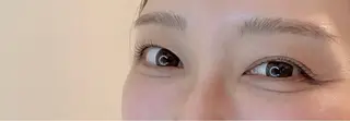マツエク・マツパ 【医療提携】脱毛 小顔ハーブピーリングのその他イメージ