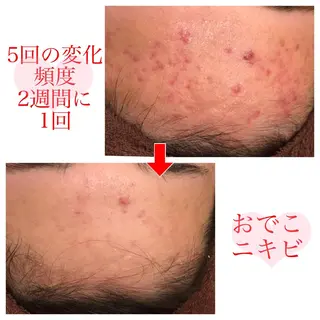 ミディアム カラー パーマ ヘアアレンジ メンズ キッズ ネイル マツエク・マツパ 金の糸脱毛 産毛ケア専門のエステ・リラクイメージ
