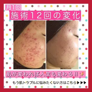 ミディアム カラー パーマ ヘアアレンジ メンズ ネイル マツエク・マツパ ニキビ・肌質改善専門 ♡人生が変わるサロンのエステ・リラクイメージ