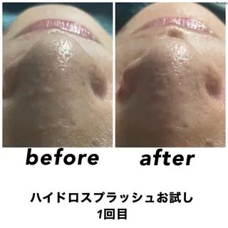 ネイル・エステサロン UILANIのエステ・リラクイメージ