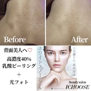 CHOOSE/島田 根本改善/代々木上原のエステ・リラクイメージ