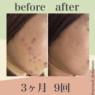 ミディアム カラー パーマ ヘアアレンジ メンズ キッズ ネイル マツエク・マツパ ニキビ・肌質改善専門 ♡人生が変わるサロンのエステ・リラクイメージ