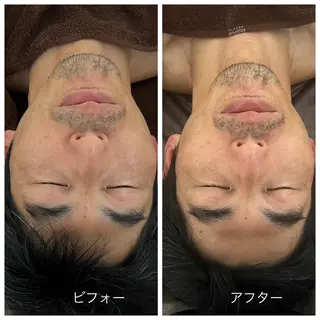 Relaxsalon undoのエステ・リラクイメージ