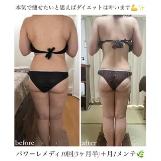 《本気痩せ×疲労改善 》  BILOOPのエステ・リラクイメージ
