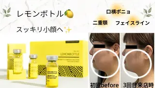 esthetic salon Ranのその他イメージ