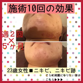 ミディアム カラー パーマ ヘアアレンジ メンズ キッズ ネイル マツエク・マツパ ニキビ・肌質改善専門 ♡人生が変わるサロンのエステ・リラクイメージ