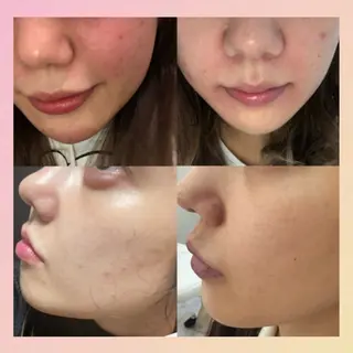 Bellebeau tysalonのエステ・リラクイメージ