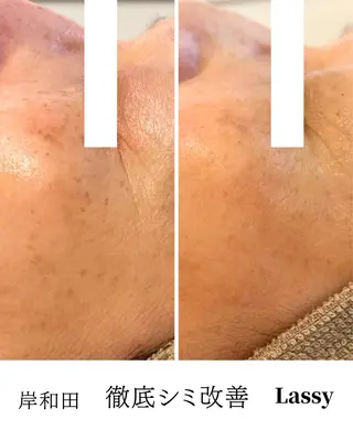 Lassy keikoの眉毛・アイブロウイメージ