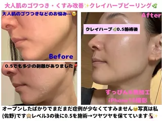 VIKI BEAUTYのエステ・リラクイメージ