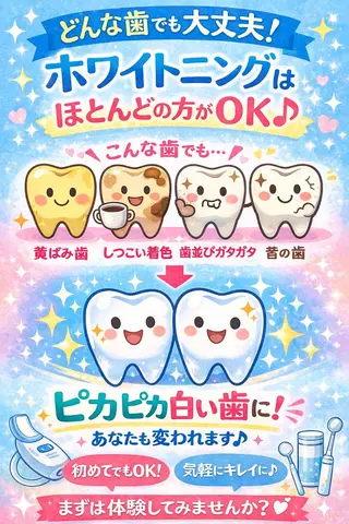 ホワイトニング ショップ船橋２号店のエステ・リラクイメージ
